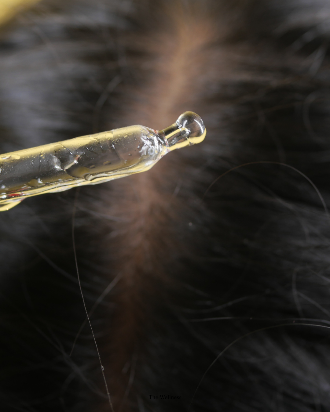 Hair Loss Causes: A Doctor's Guide to Why You Are Losing Hair (2026)