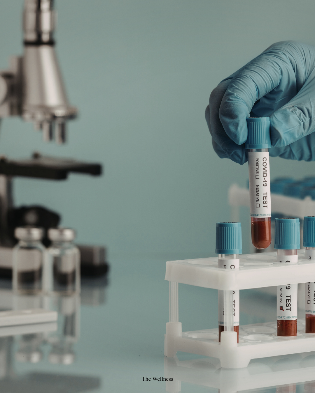 Hair Loss Blood Test: Which Tests You Need and What Results Mean (2026)