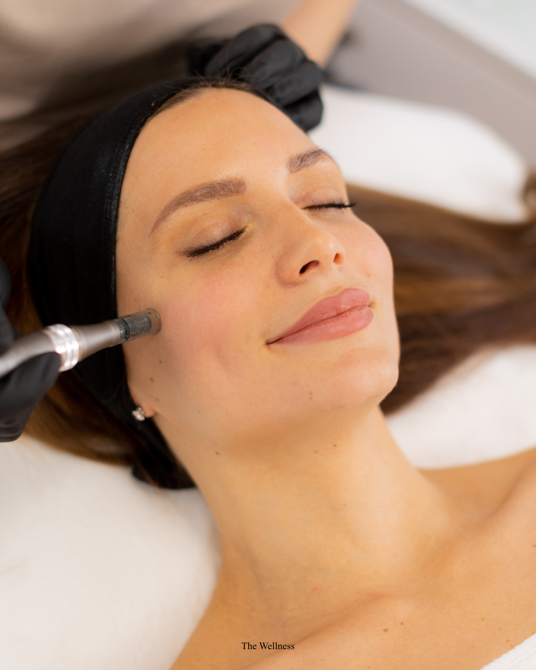 Non-Surgical Hair Restoration London: Every Option Ranked and Compared (2026)