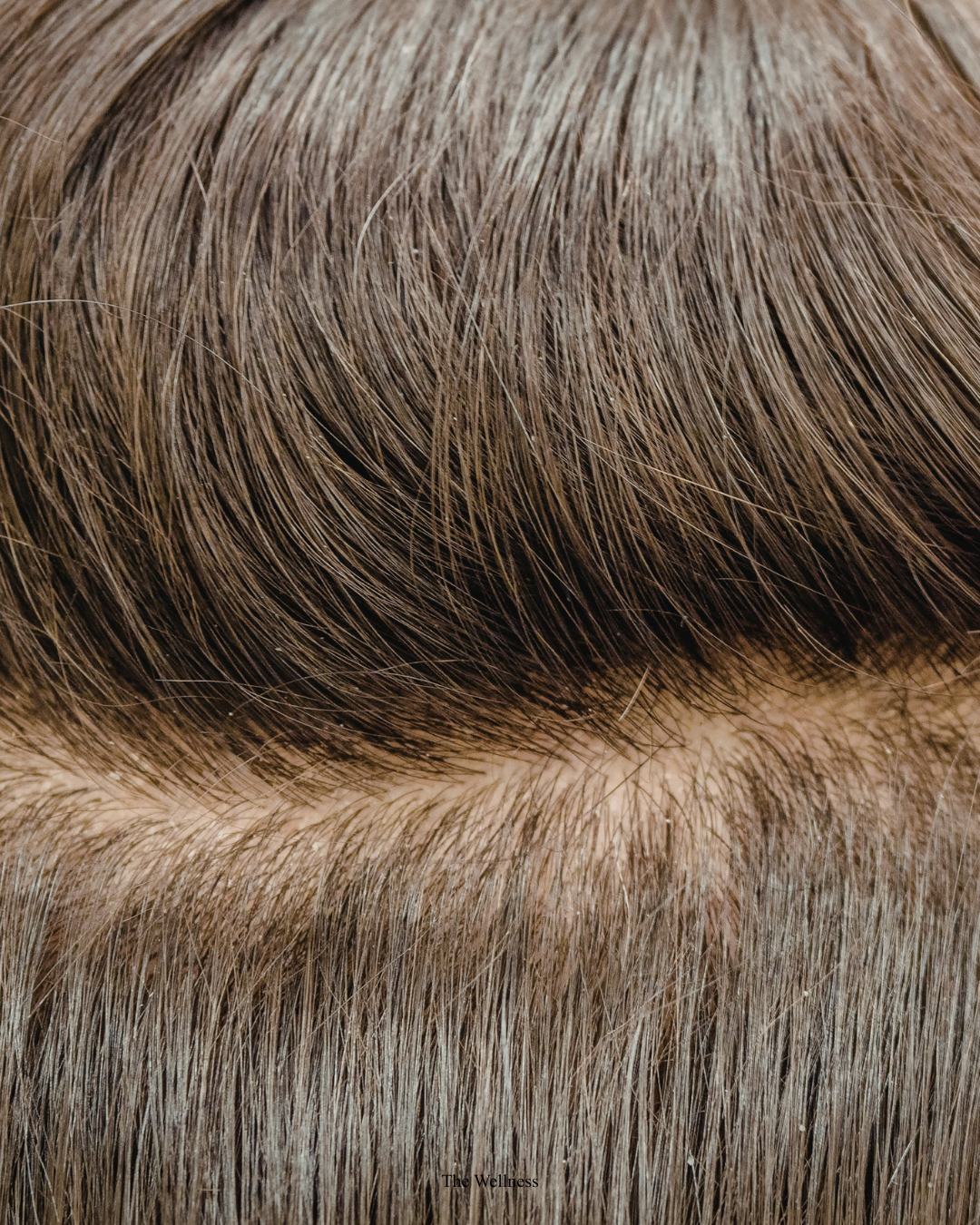 GFC Hair Treatment: Growth Factor Concentrate Explained (2026 London Guide)