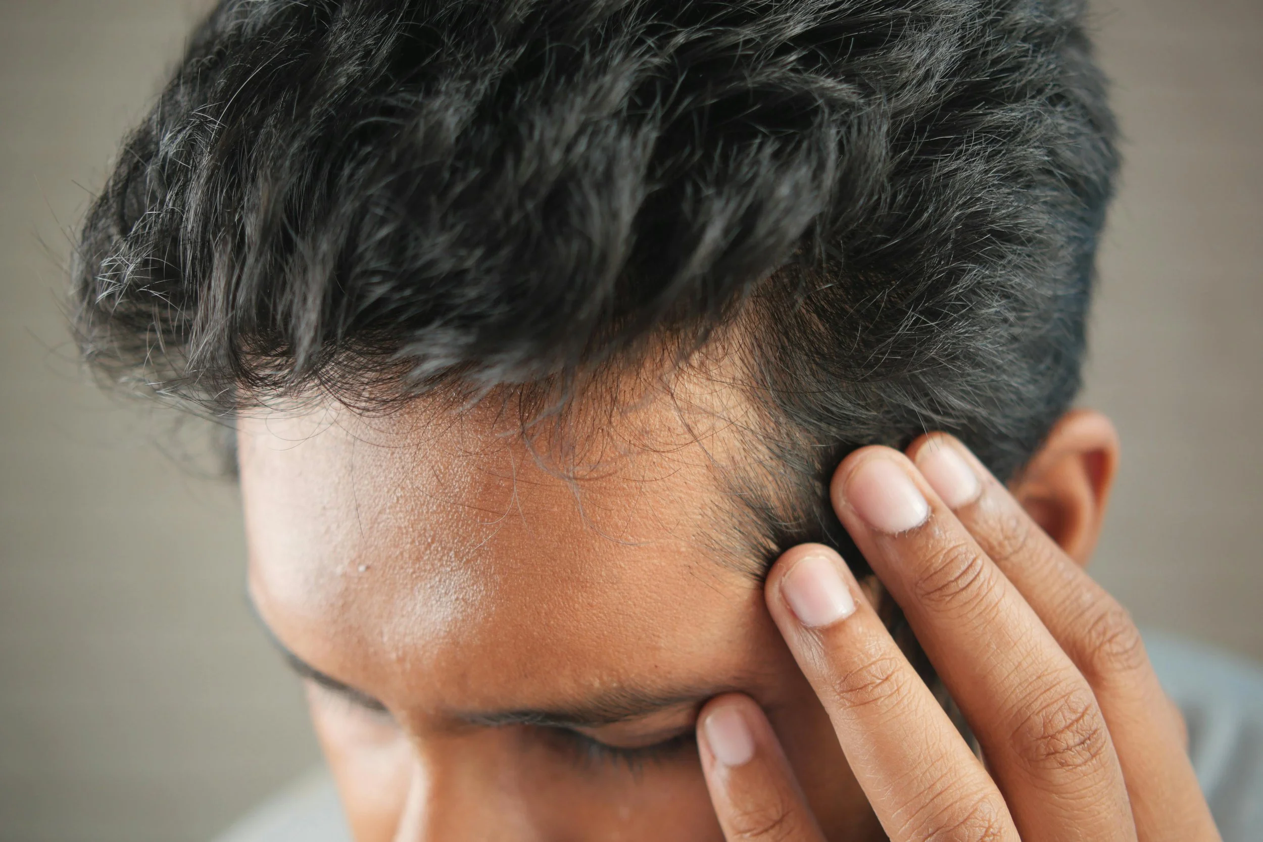 Ozempic Hair Loss: Why GLP-1 Weight Loss Drugs Cause Shedding and How to Treat It (2026)