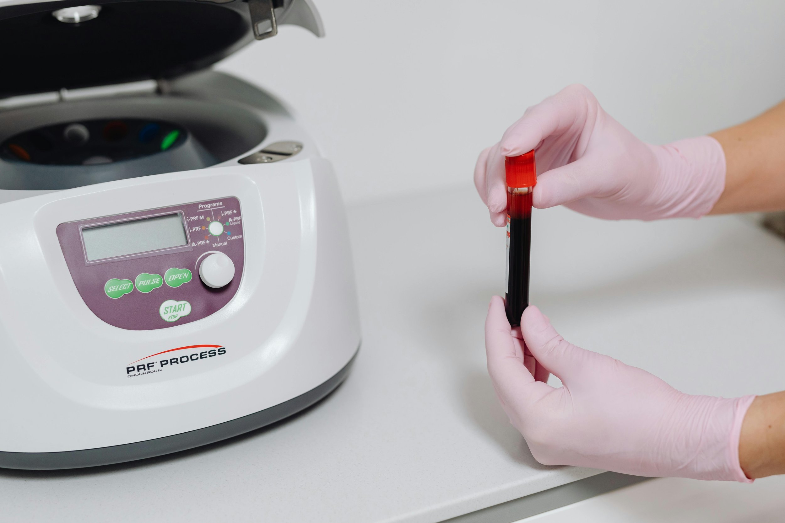 PRP vs Polynucleotides: Which Skin Treatment Is Better? (2026 London Guide)