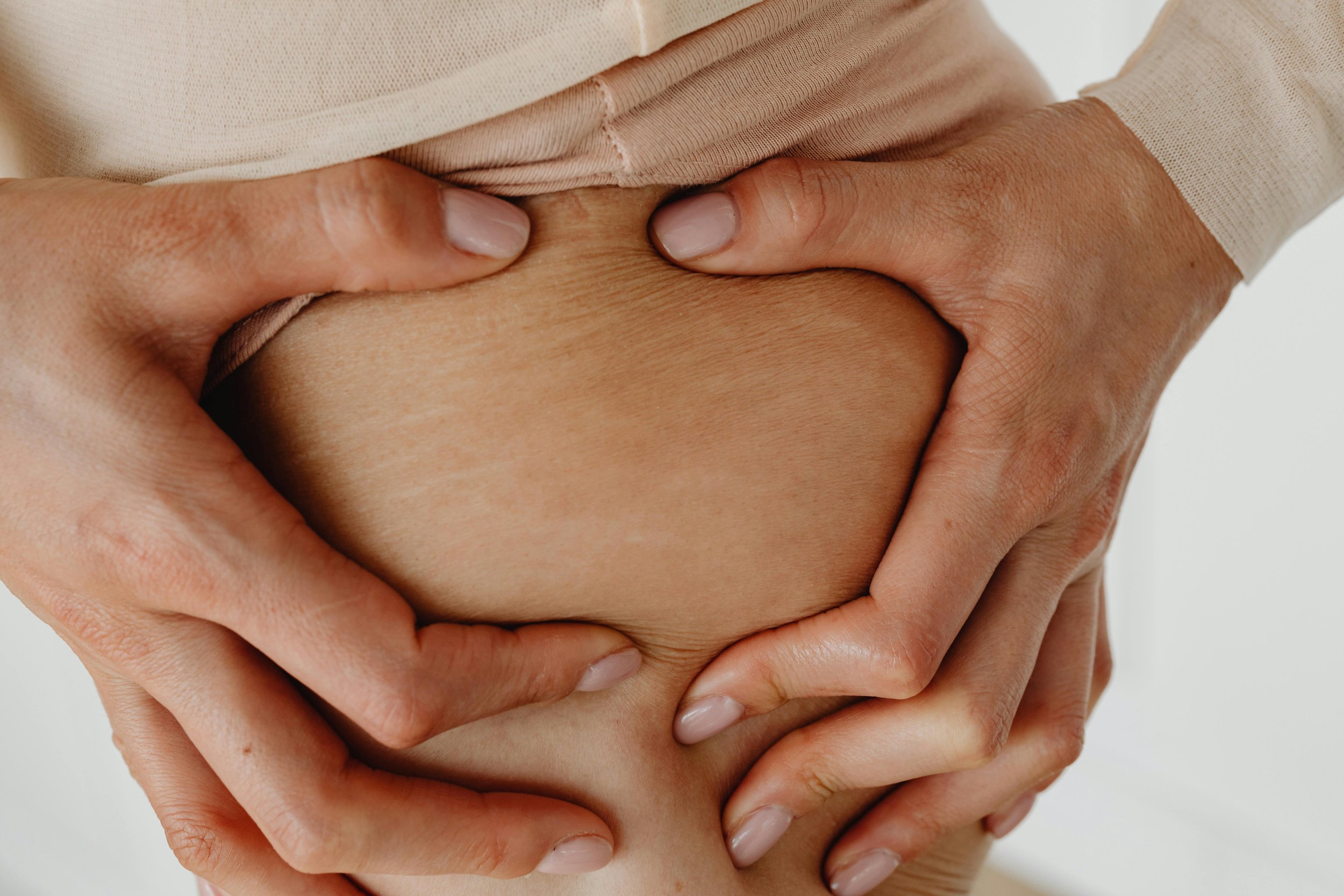 PRP for Stretch Marks and Post-Pregnancy Skin London 2026: The Doctor-Led Pathway to Restored Skin Confidence