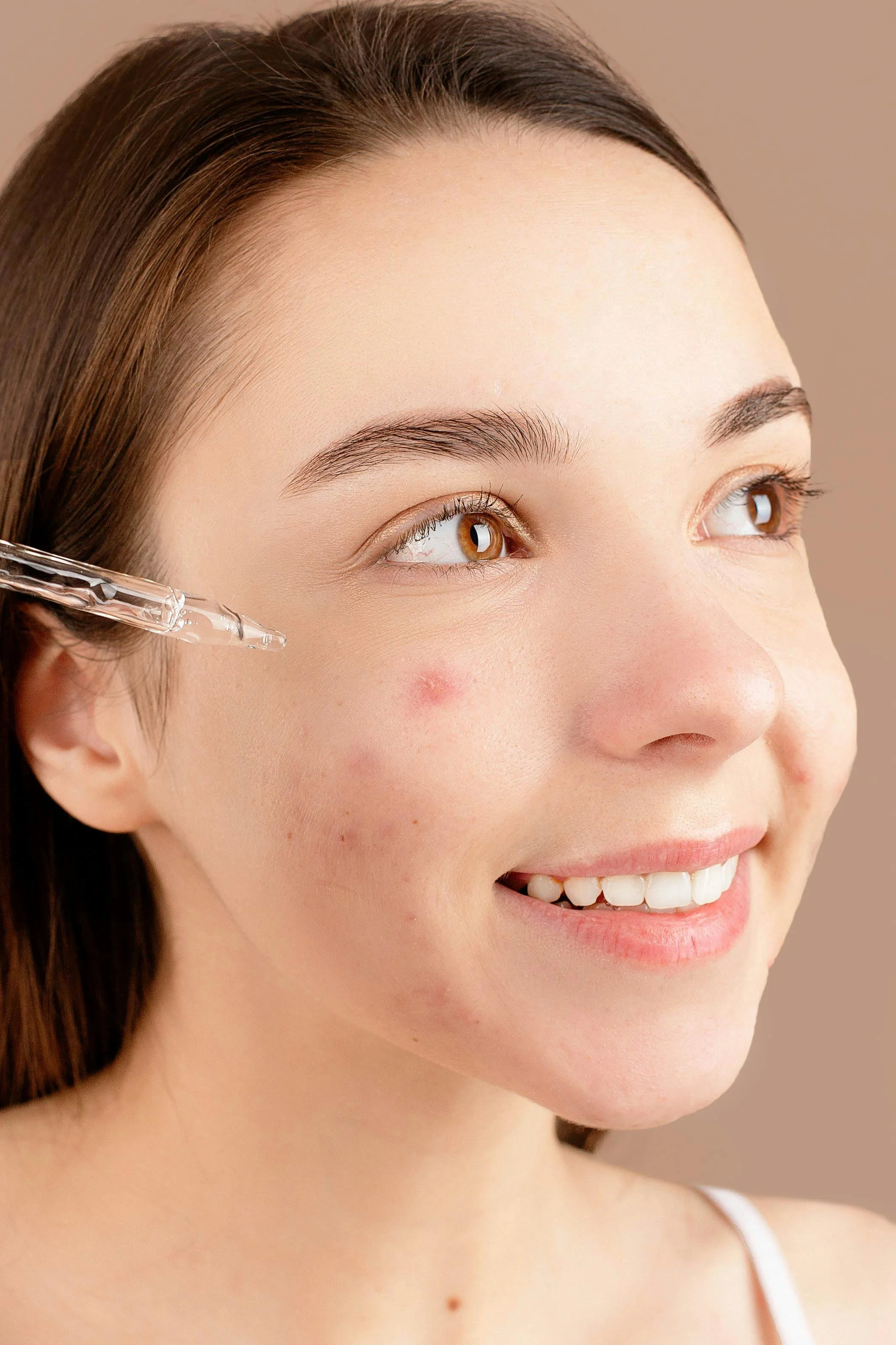 PRP for Acne Scars London 2026: The Doctor-Led Regenerative Pathway