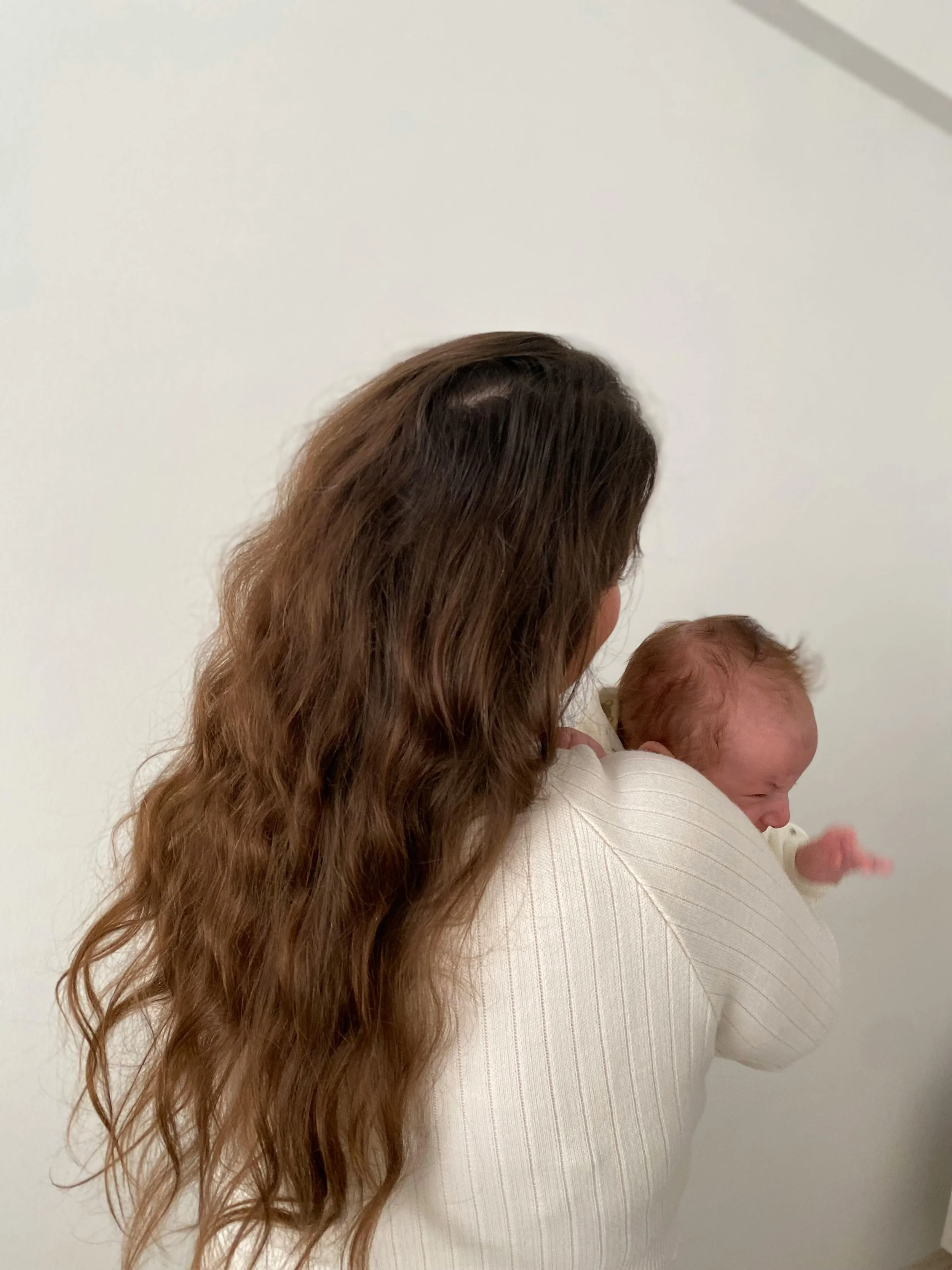 Postpartum Hair Loss London 2026: The Doctor-Led Recovery Pathway