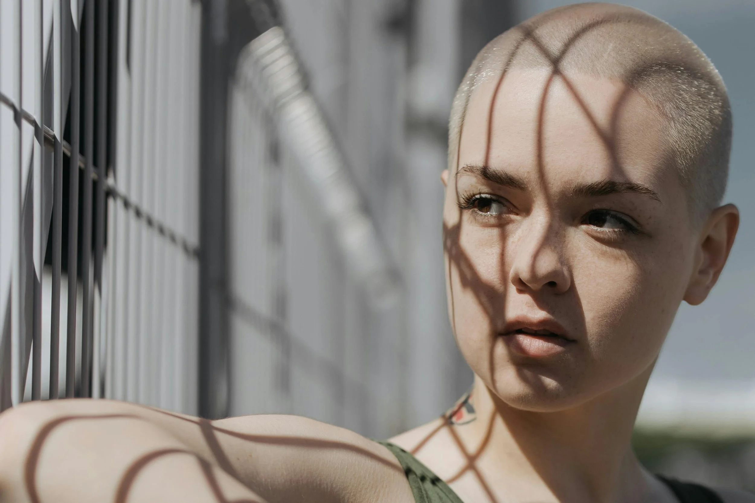Frontal Fibrosing Alopecia (FFA) London 2026: The Doctor-Led Diagnostic and Treatment Pathway