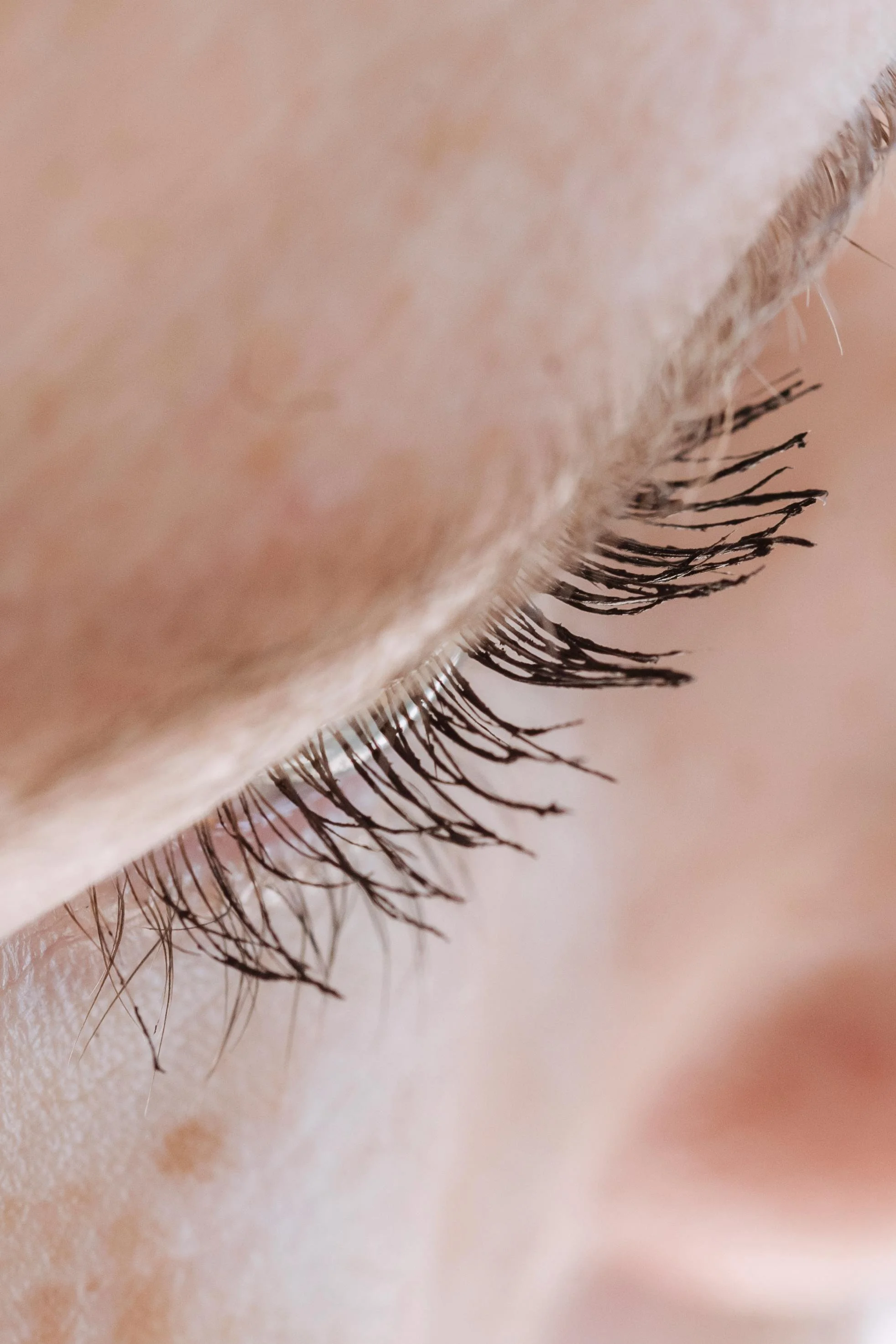 Eyelash Restoration London 2026: The Doctor-Led Pathway to Fuller Lashes