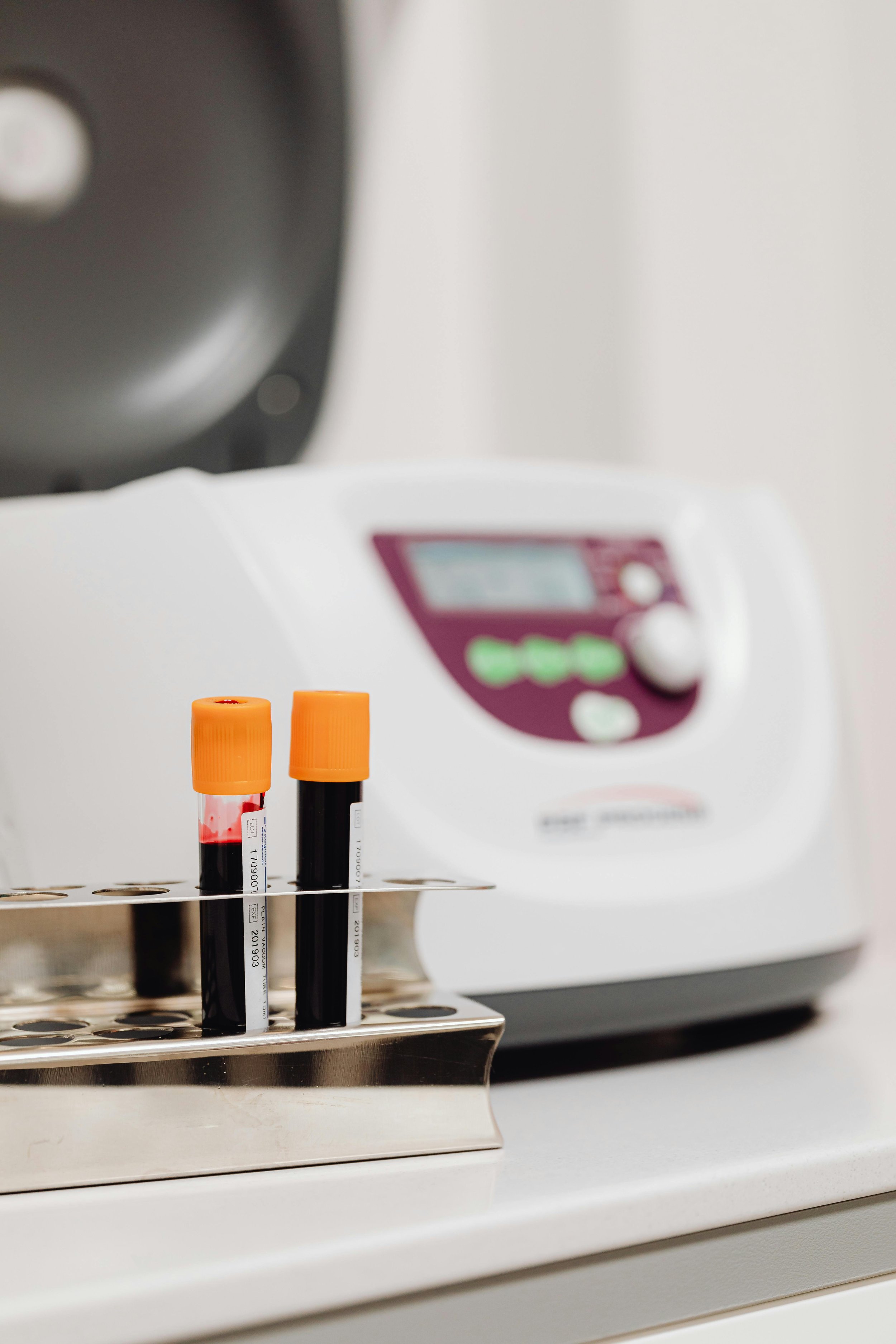 Polynucleotides Under Eyes London. Dark Circles, Crepey Skin And What To Expect
