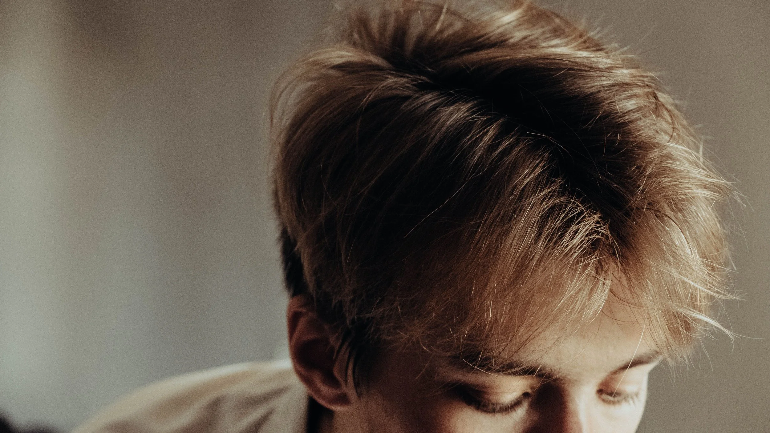 Is PRP For Hair Worth It. An Honest, Evidence-Based Answer