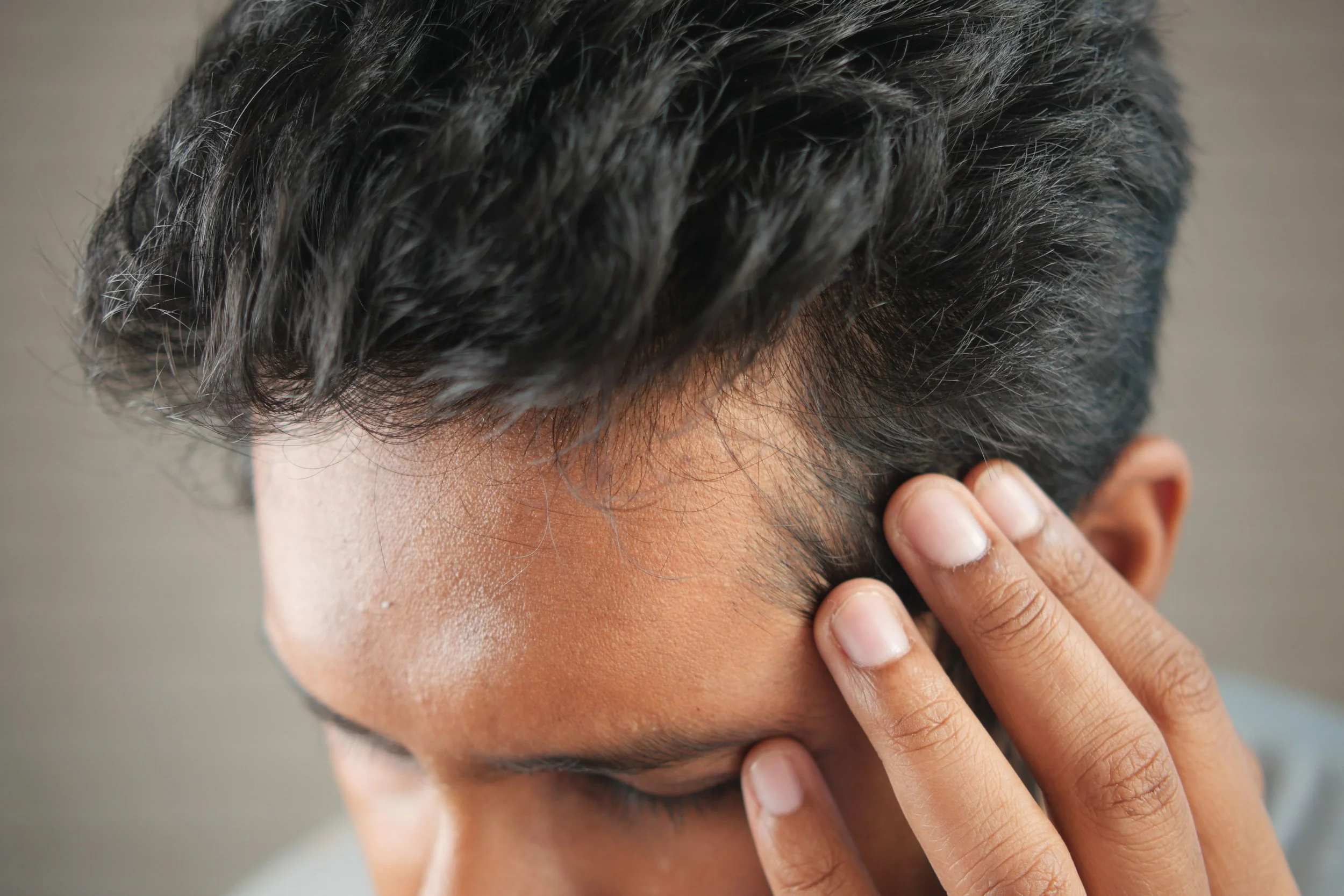 Hair Loss After Illness, Surgery Or COVID. Why It Happens And What Helps