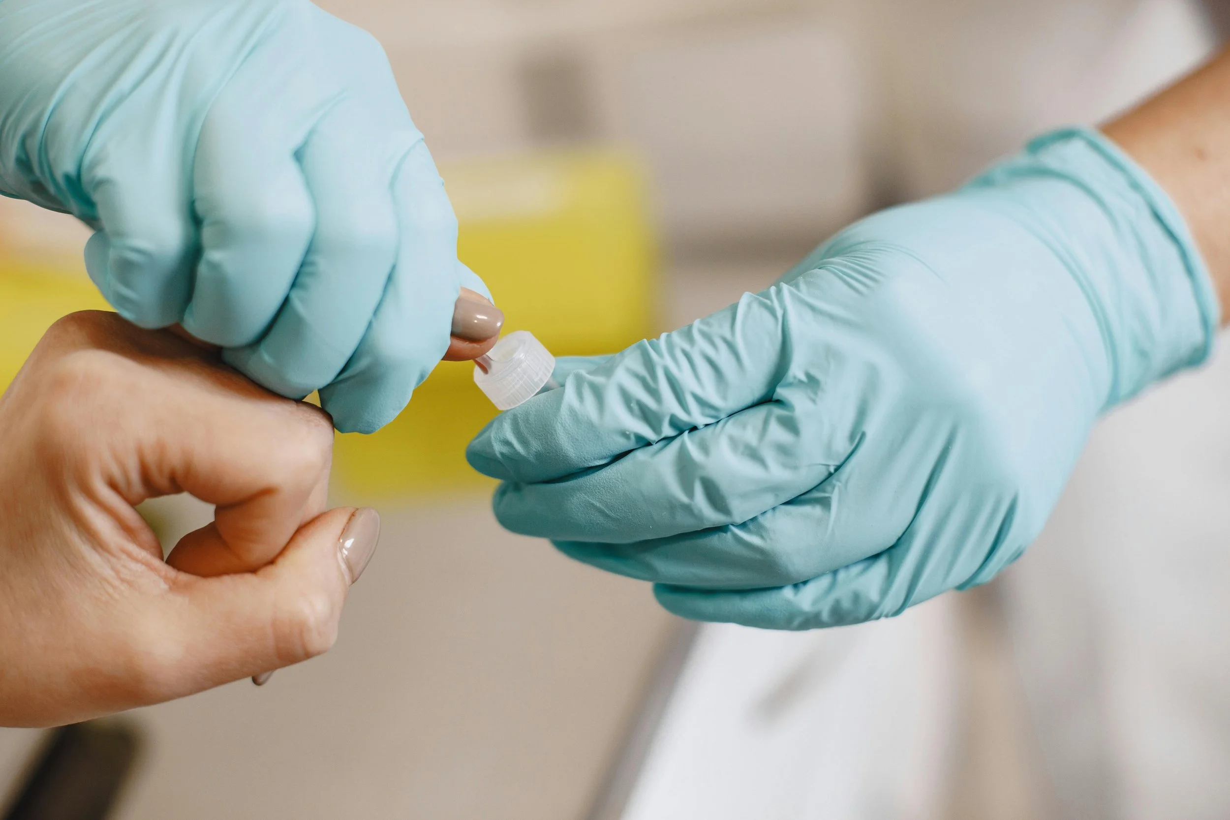 How Long Do PRP Hair Results Last And How Often Do You Need It