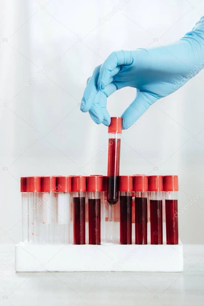 Blood Tests for Hair, Skin and Health in London. Finding the Cause From Within
