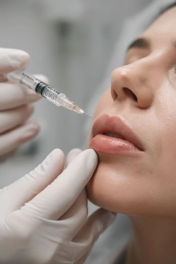 Lip Flip in London. The Subtle, Doctor-Led Alternative to Filler