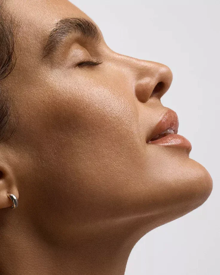 Rosacea Treatment in London. The Doctor-Led, Honest Guide