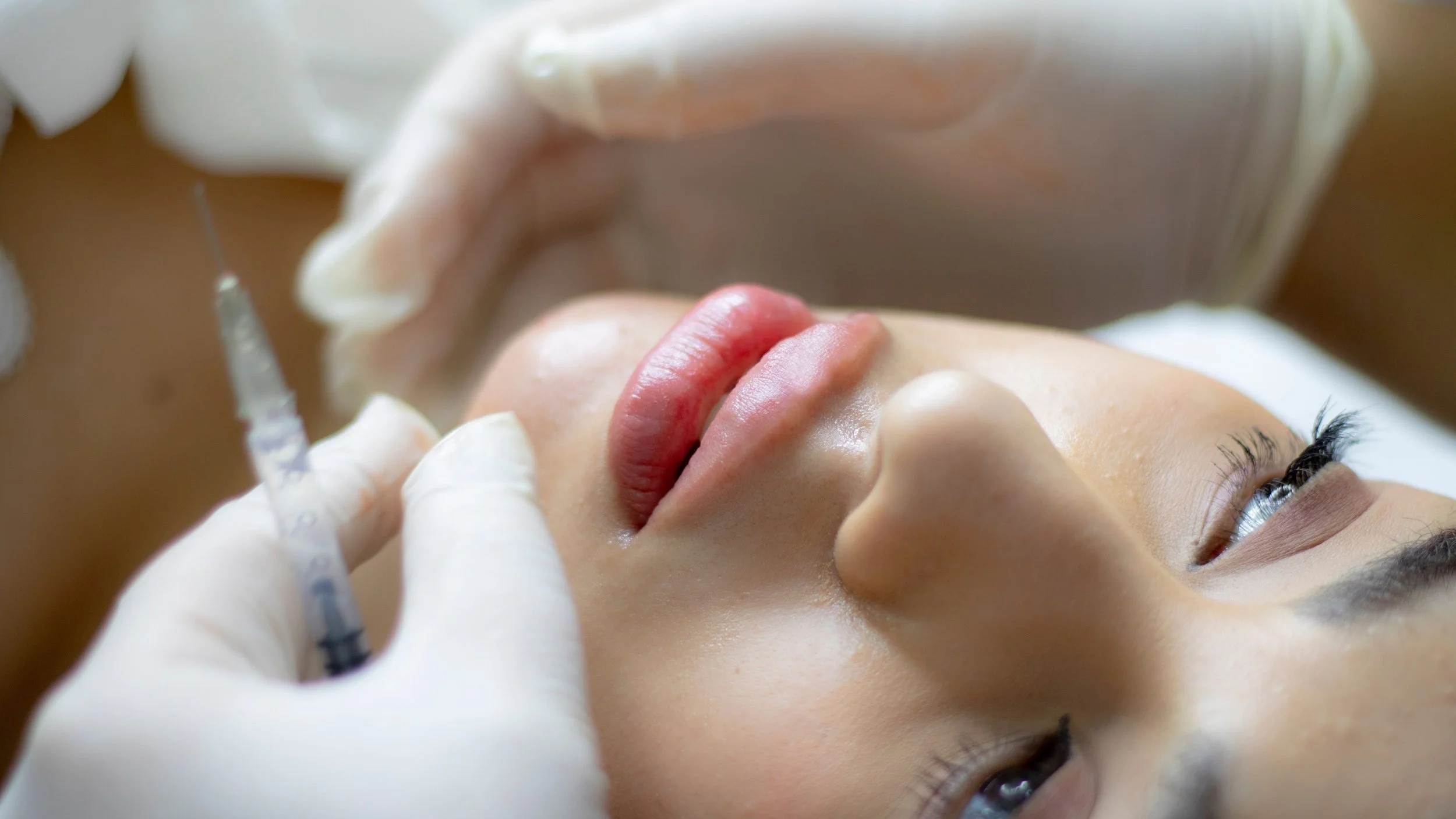 Lip PRP in London