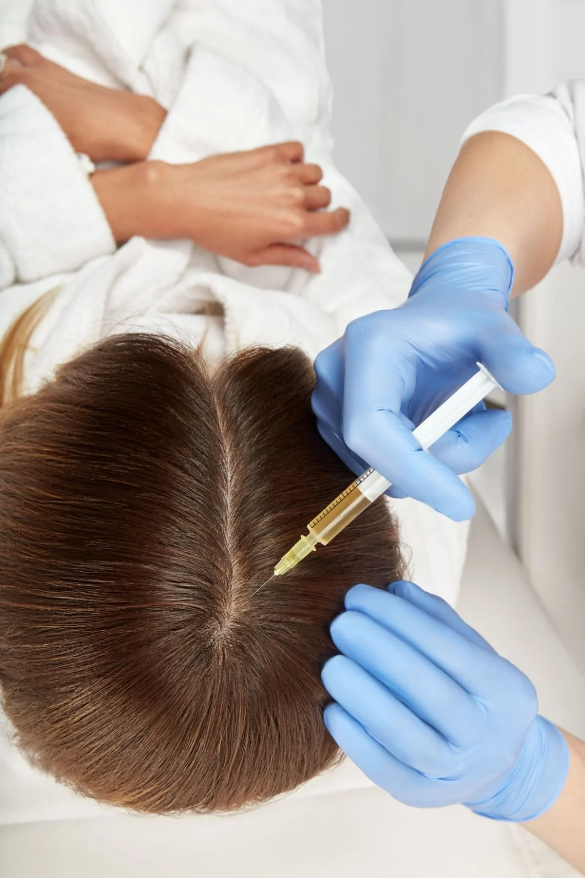 Sudden Hair Shedding (Telogen Effluvium) in London 2026. The Doctor-Led Diagnostic Pathway