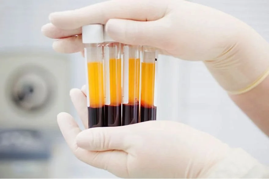 Does PRP Actually Work. The Evidence, Condition By Condition