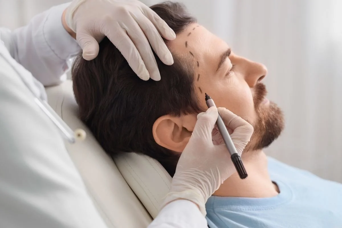 Hair Transplant In Turkey. What A UK Doctor Wants You To Know First
