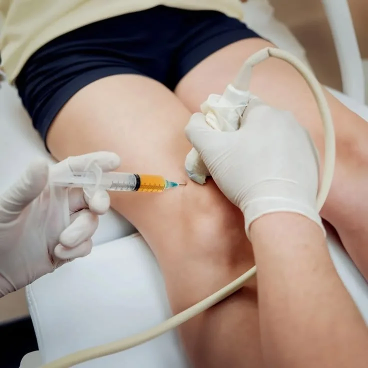 What Is Intraosseous PRP and Does Injecting the BoneWork Better Than the Joint