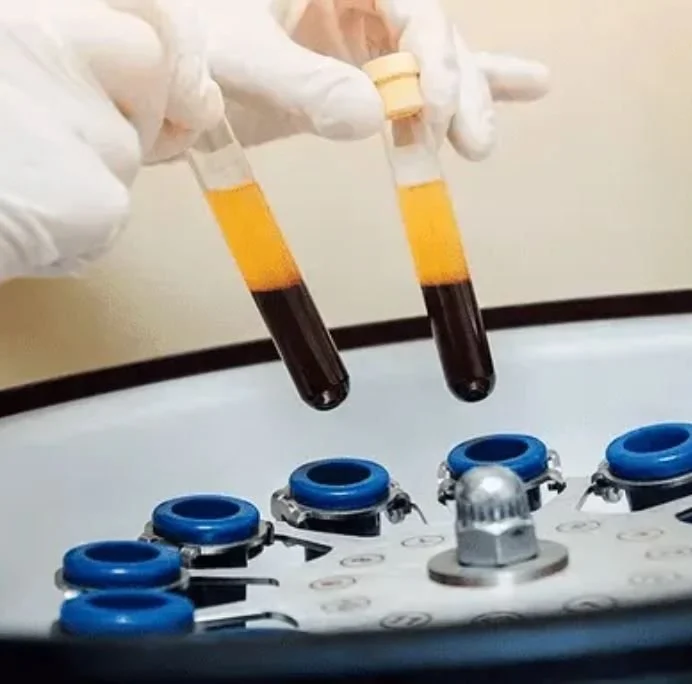 Leukocyte Rich or Leukocyte Poor PRP. Which Type Is Right for Your Joint
