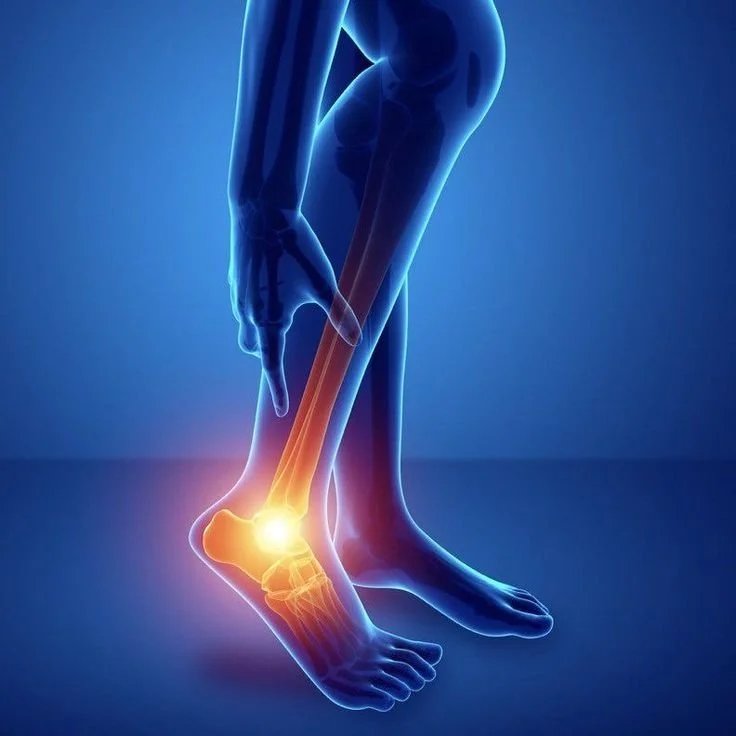 Does PRP Work for Ankle Arthritis and Ankle Sprains