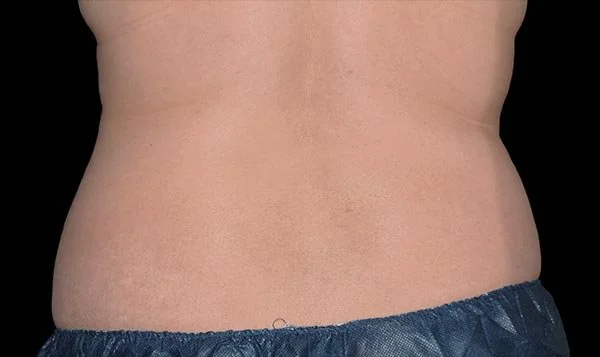 Weight loss services Forney Texas