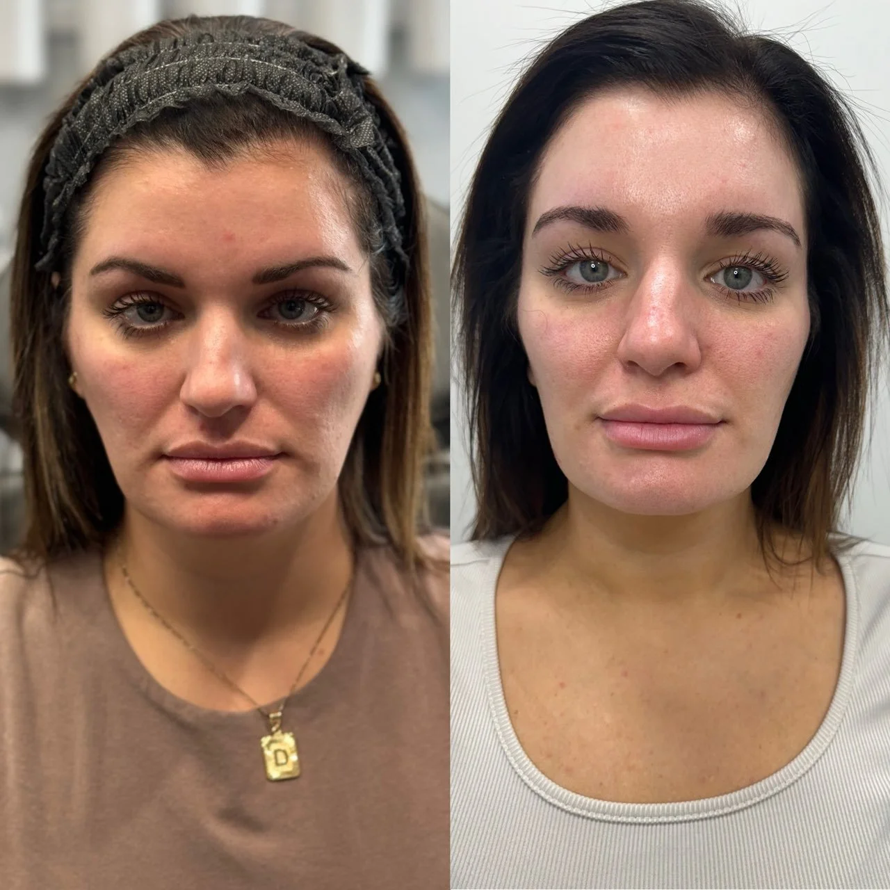 Side by side comparison showing a woman's face before and after a treatment, highlighting changes in skin appearance and makeup.