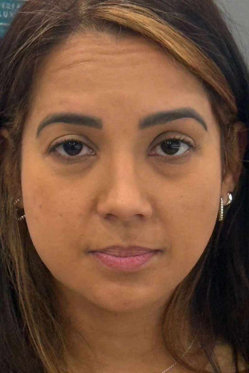resultado-dr-pardo-07-antes.jpg