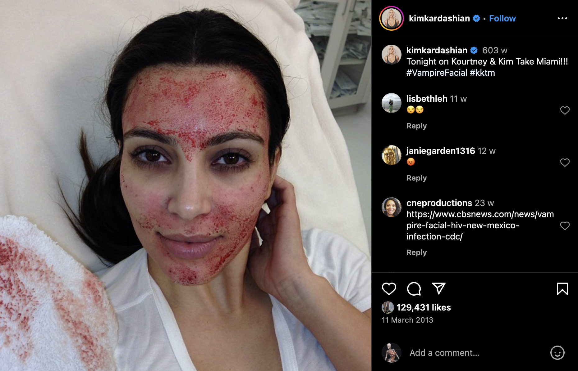 dream 002: vampire facials