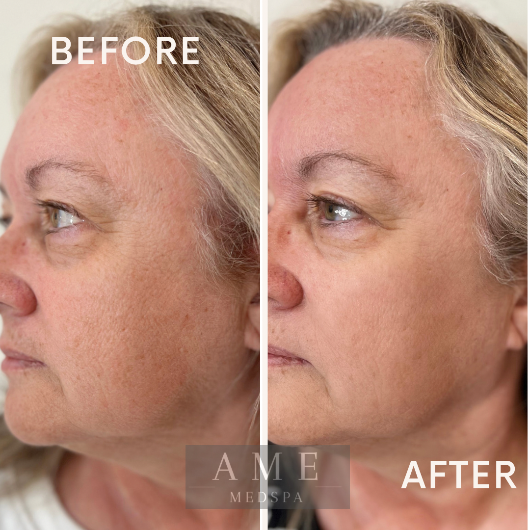 anti aging treatment leander texas