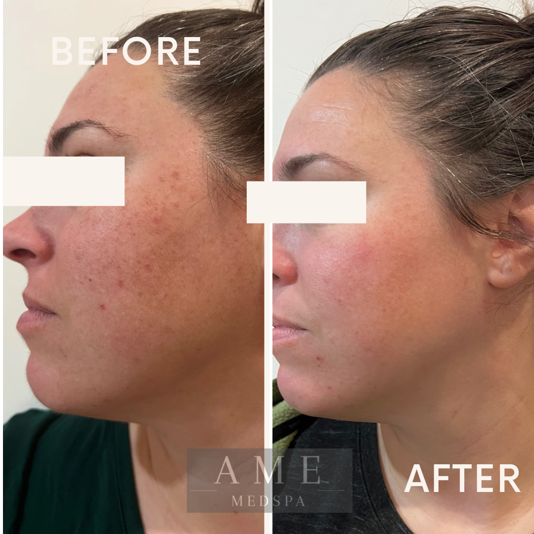 Anti aging treatment in Leander tx