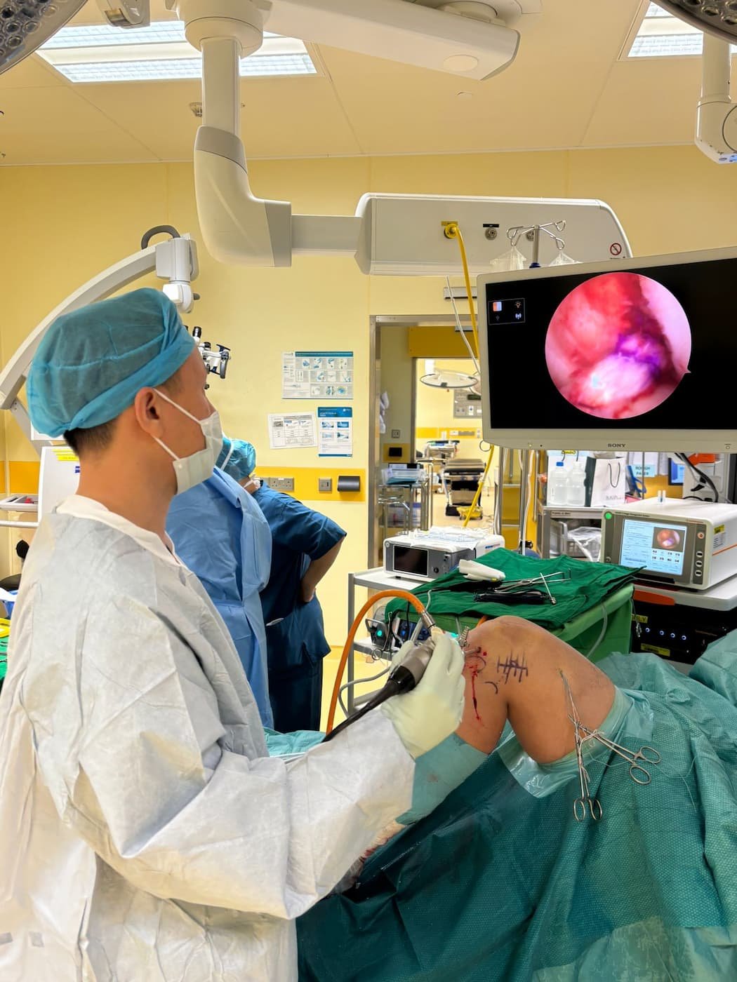 Dr Bryan wang performing arthroscopic surgery acl recon