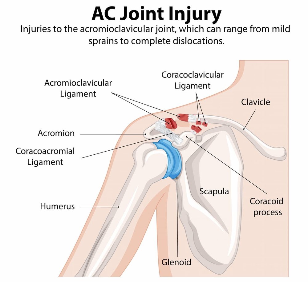 Shoulder Joint Pain | Shoulder Specialist Singapore
