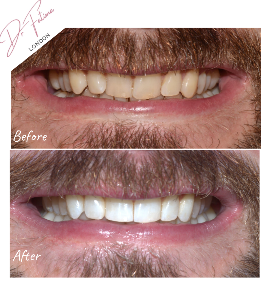 Untitled presentation (59).png