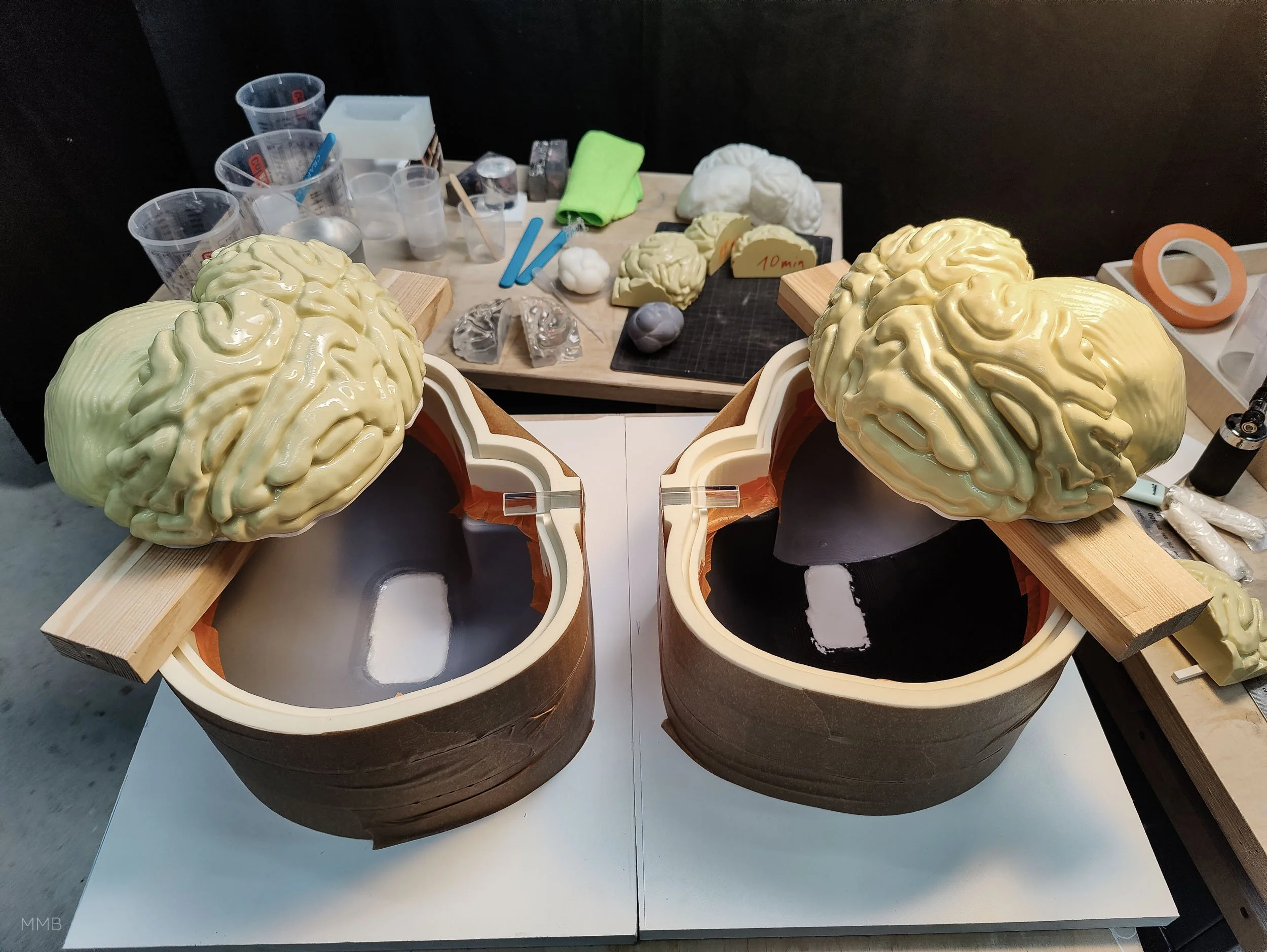 Gehirntumor Modell - Exponat von Modellbau Milde Berlin für zeitraum berlin GmbH