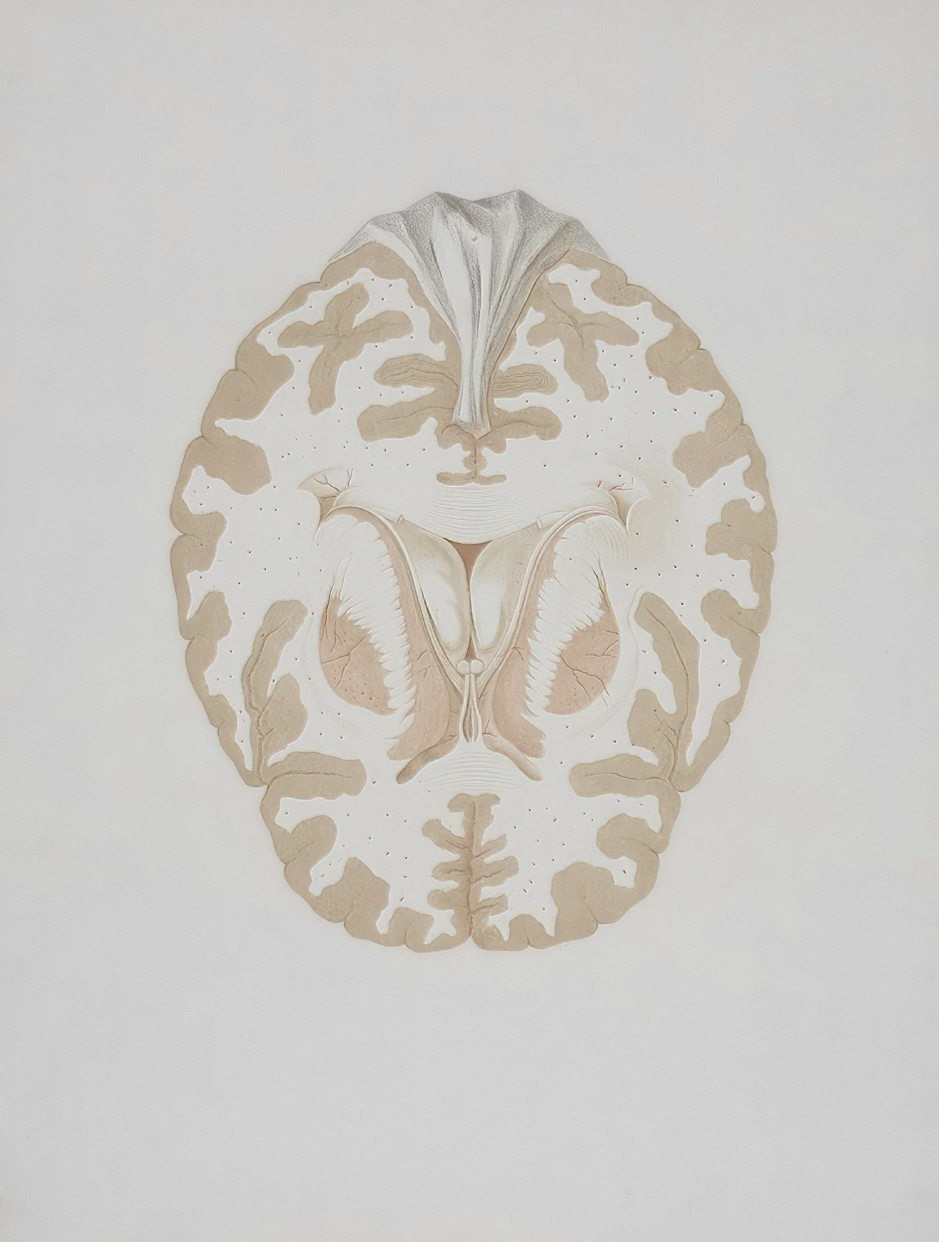 EMDR vs Brainspotting