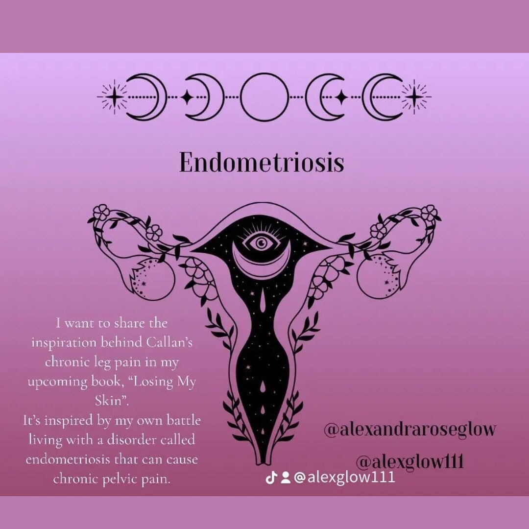 My own battle with endometriosis and the chronic pelvic pain it causes, inspired Callan&rsquo;s chronic leg pain in my upcoming book, &ldquo;Losing My Skin&rdquo;. Her pain is not believed, she is exhausts all medical treatments and tests, ultimately