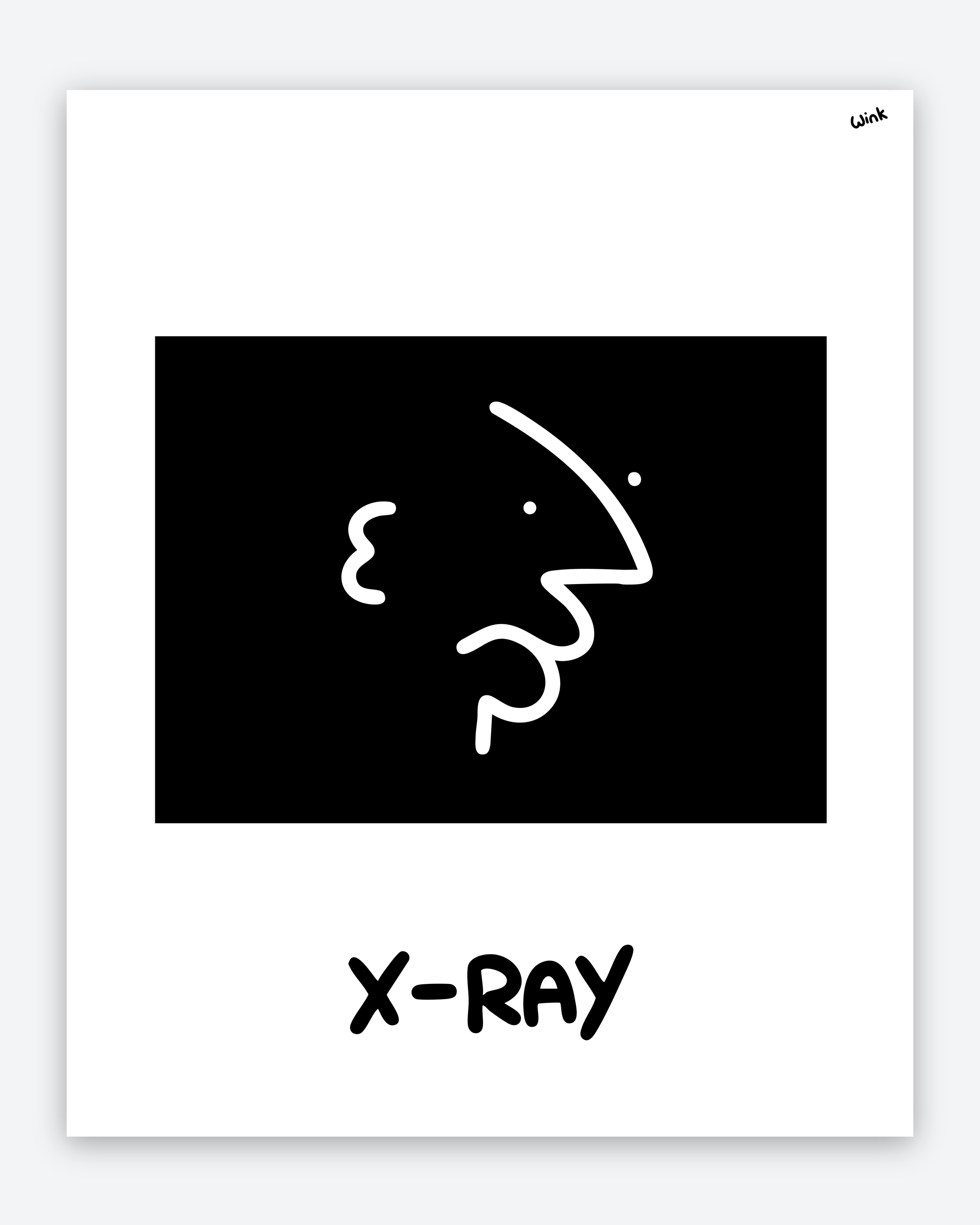 X-RAY HEADS 2 IG.png