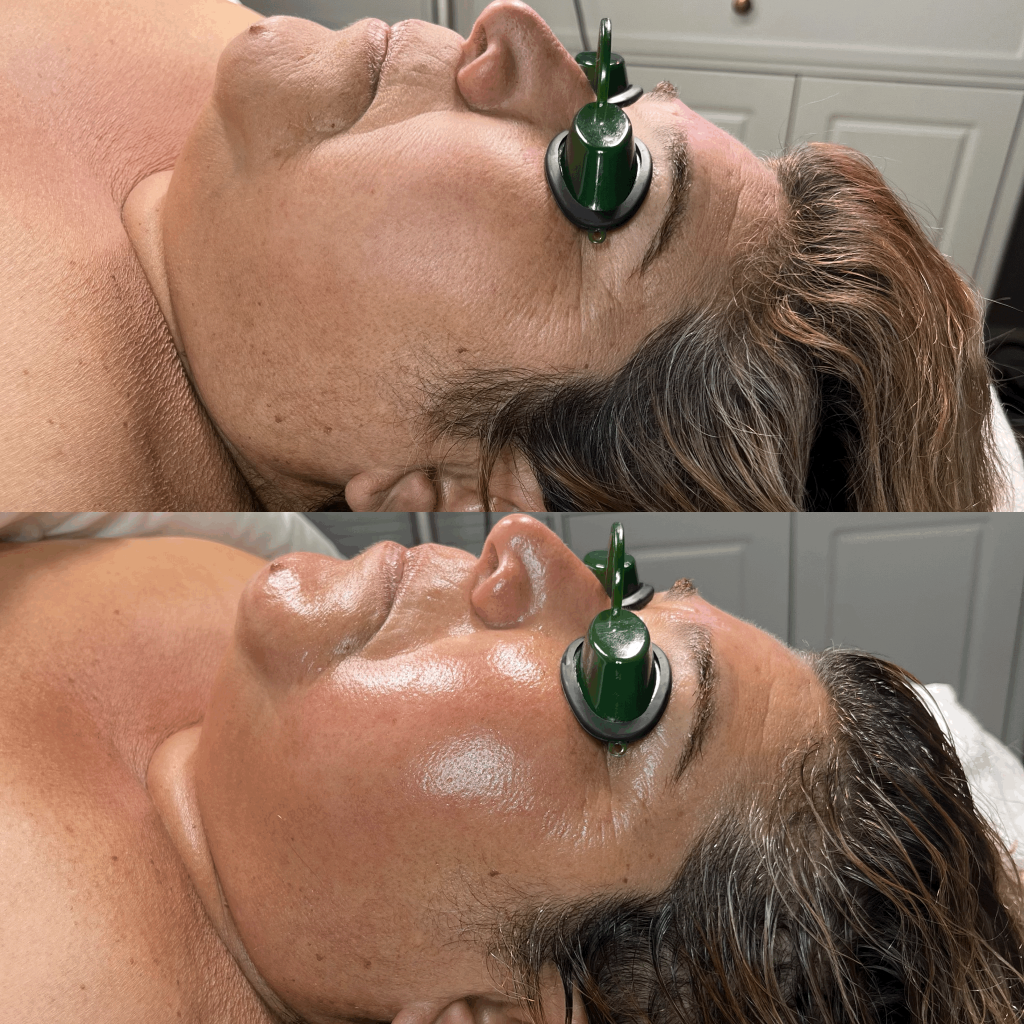 Face Sculpting Facial Massage Before & After