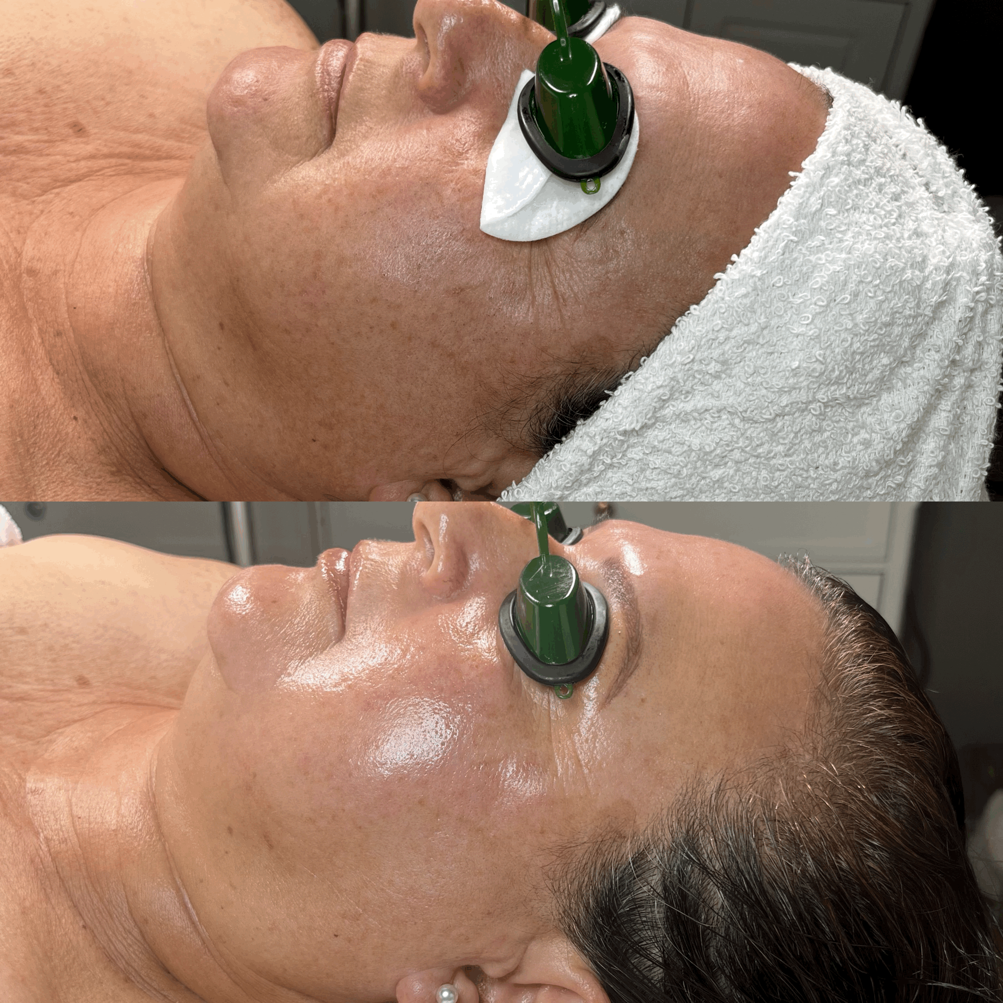 Face Sculpting Facial Massage Before & After