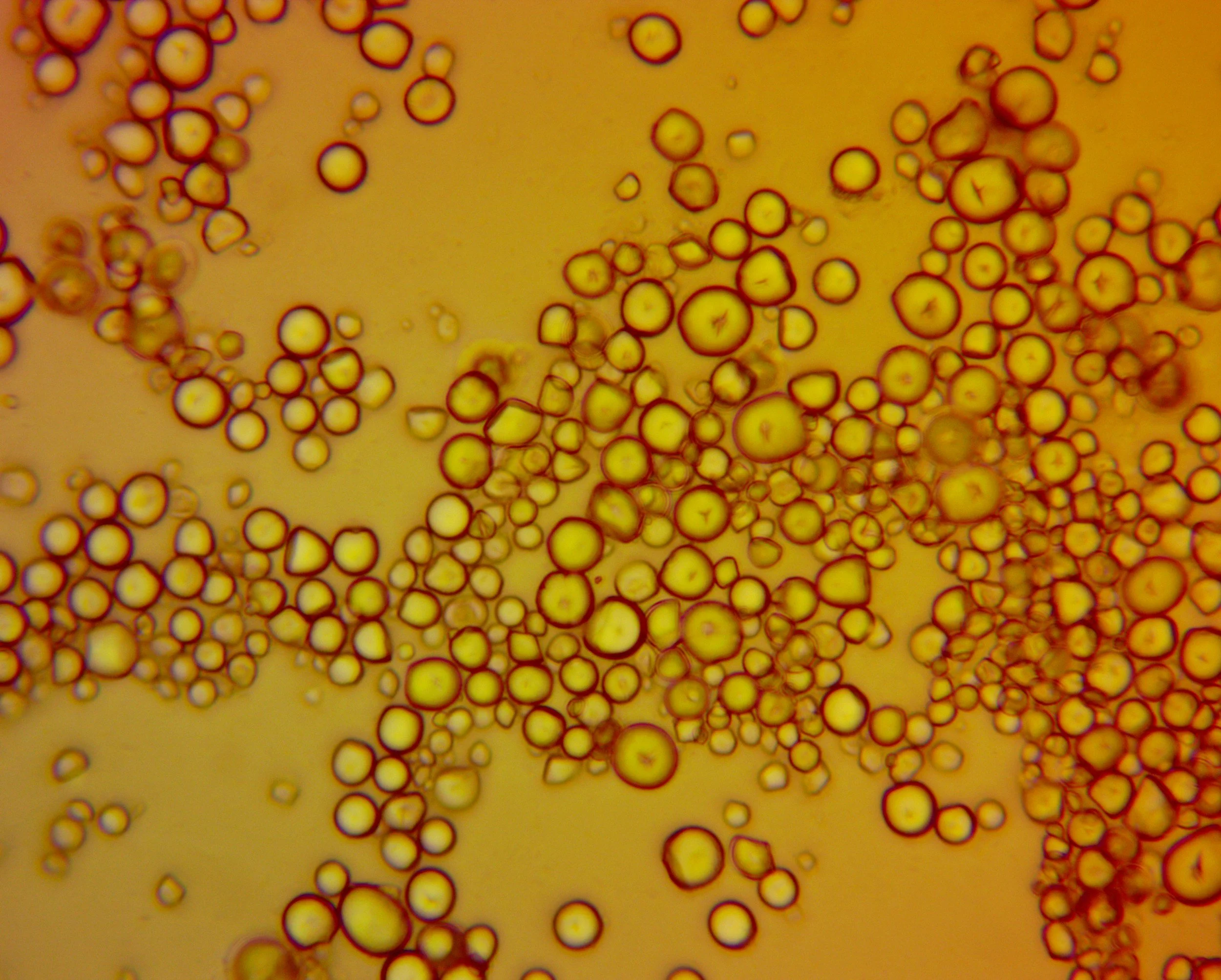 What Causes Cloudy Urine? Signs, Risks, and Treatments