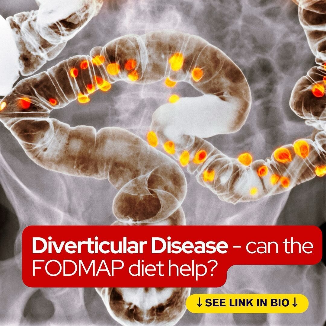 Can the FODMAP diet help reduce the symptoms of diverticular disease? Read the latest research - see link in bio for FODMAP News

#IBS #GutHealth #DigestiveHealth #LowFODMAPDiet #diverticulardisease #diverticulitis #diverticular #DietitianAdvice #IBS