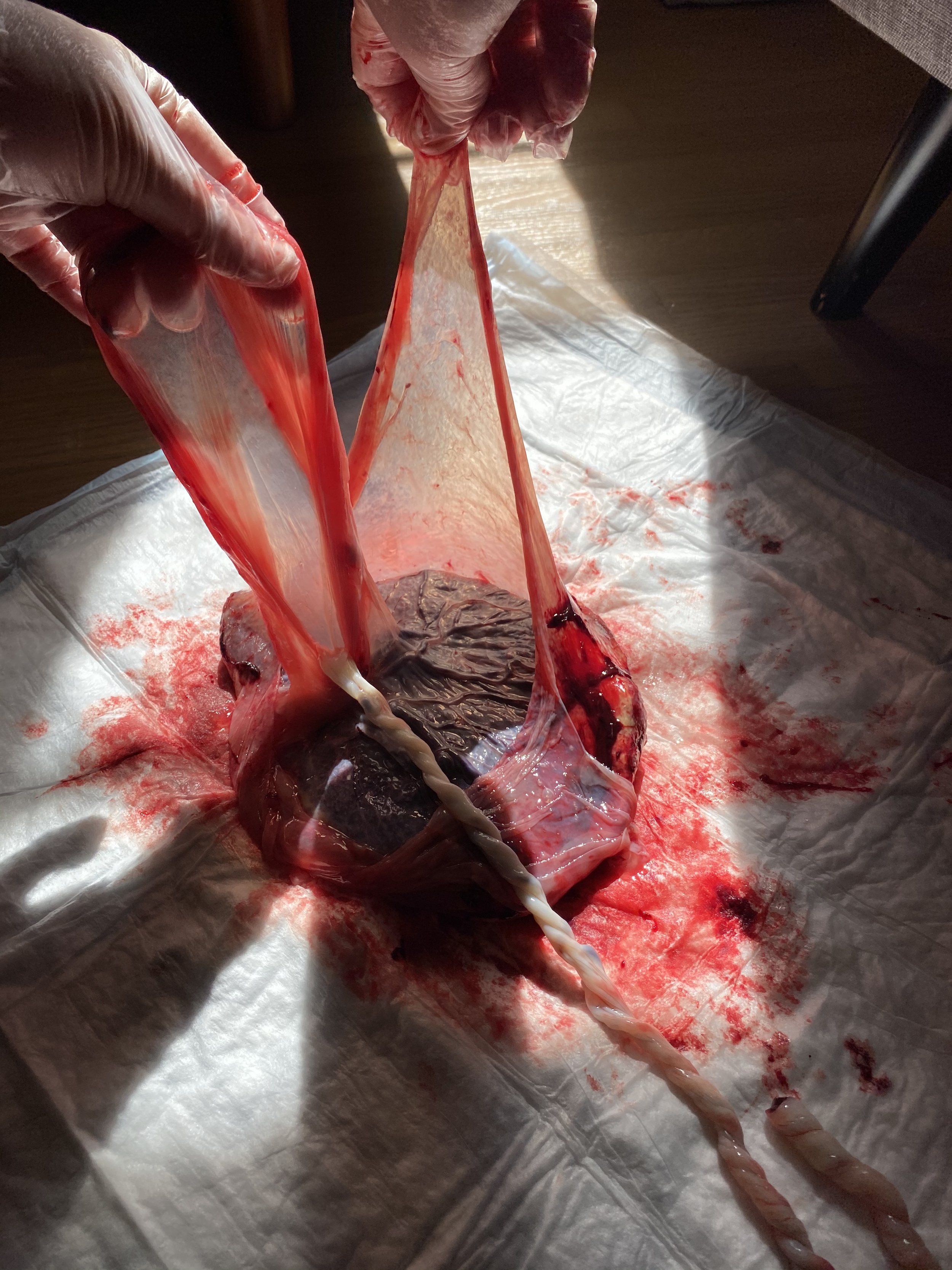 A person wearing gloves handling a placenta.