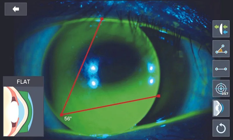 Contact Lens Fitting Assistance Guide