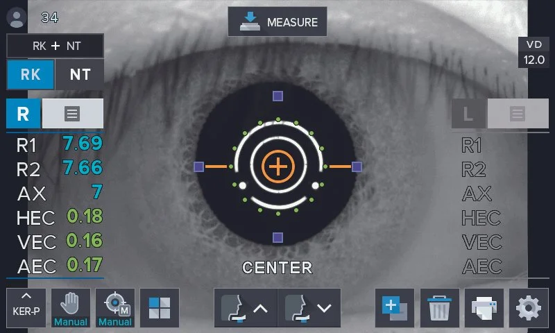 Peripheral Keratometry Measurement
