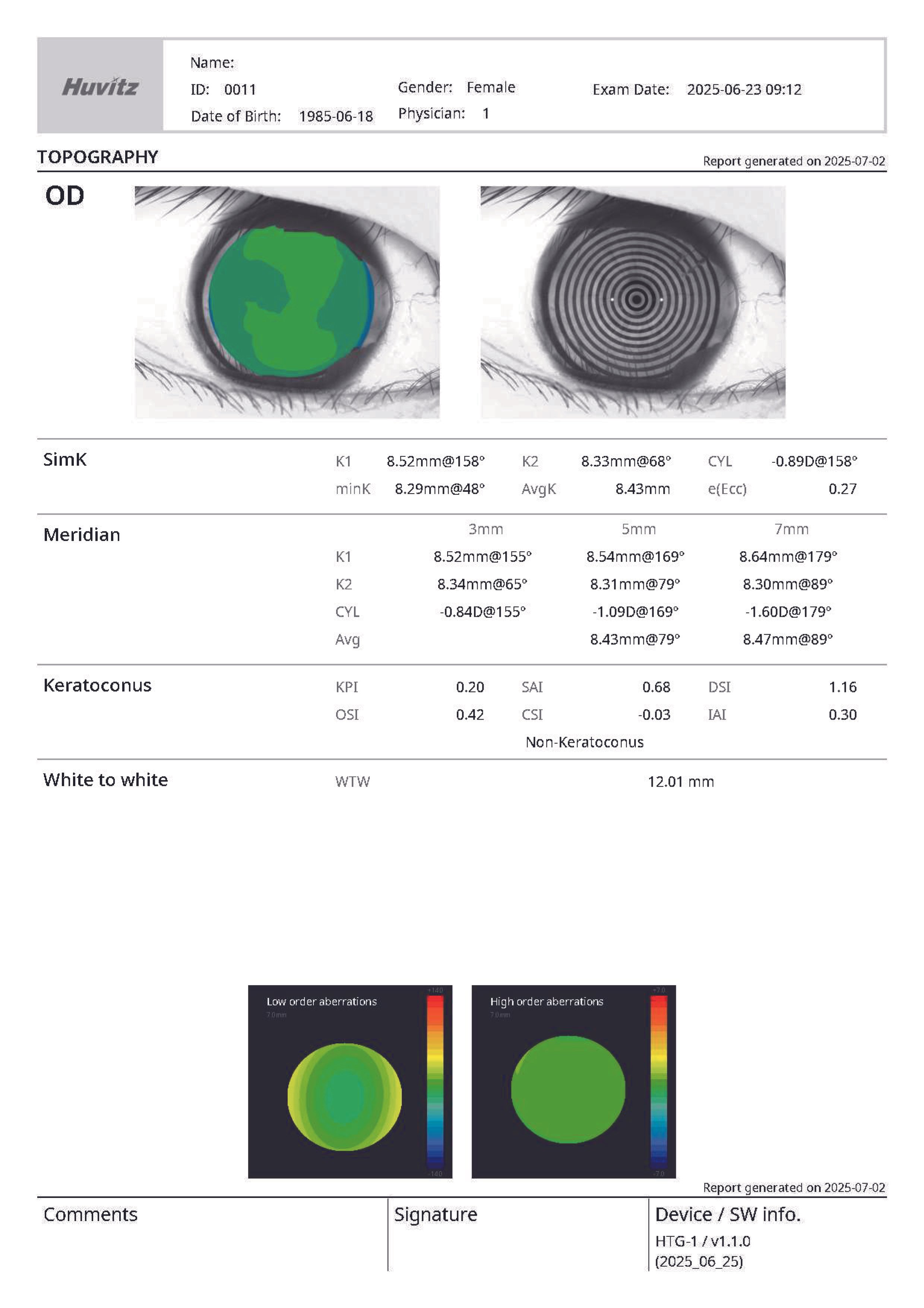 Huvitz HTG-1 Corneal Topographer