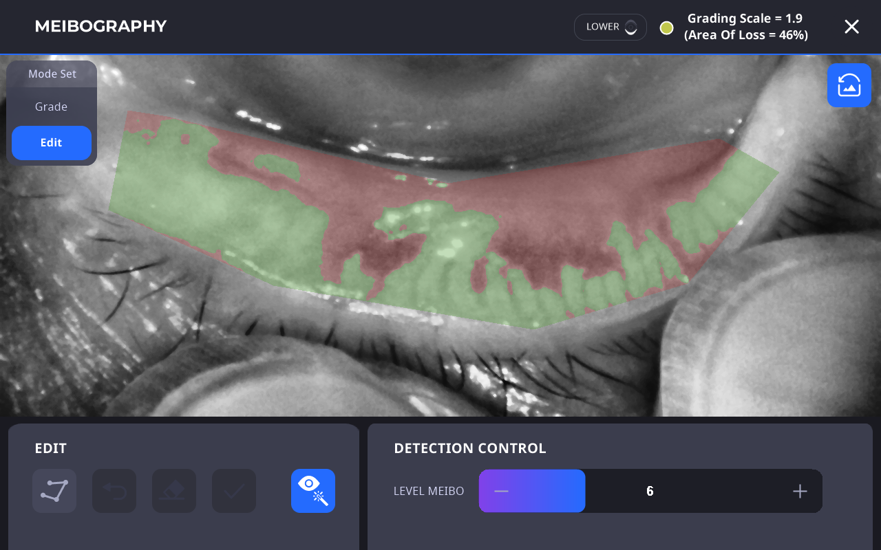 Huvitz HTG-1 Corneal Topographer