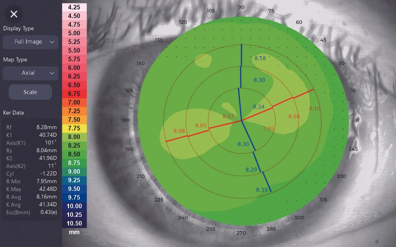 Huvitz HTG-1 Corneal Topographer