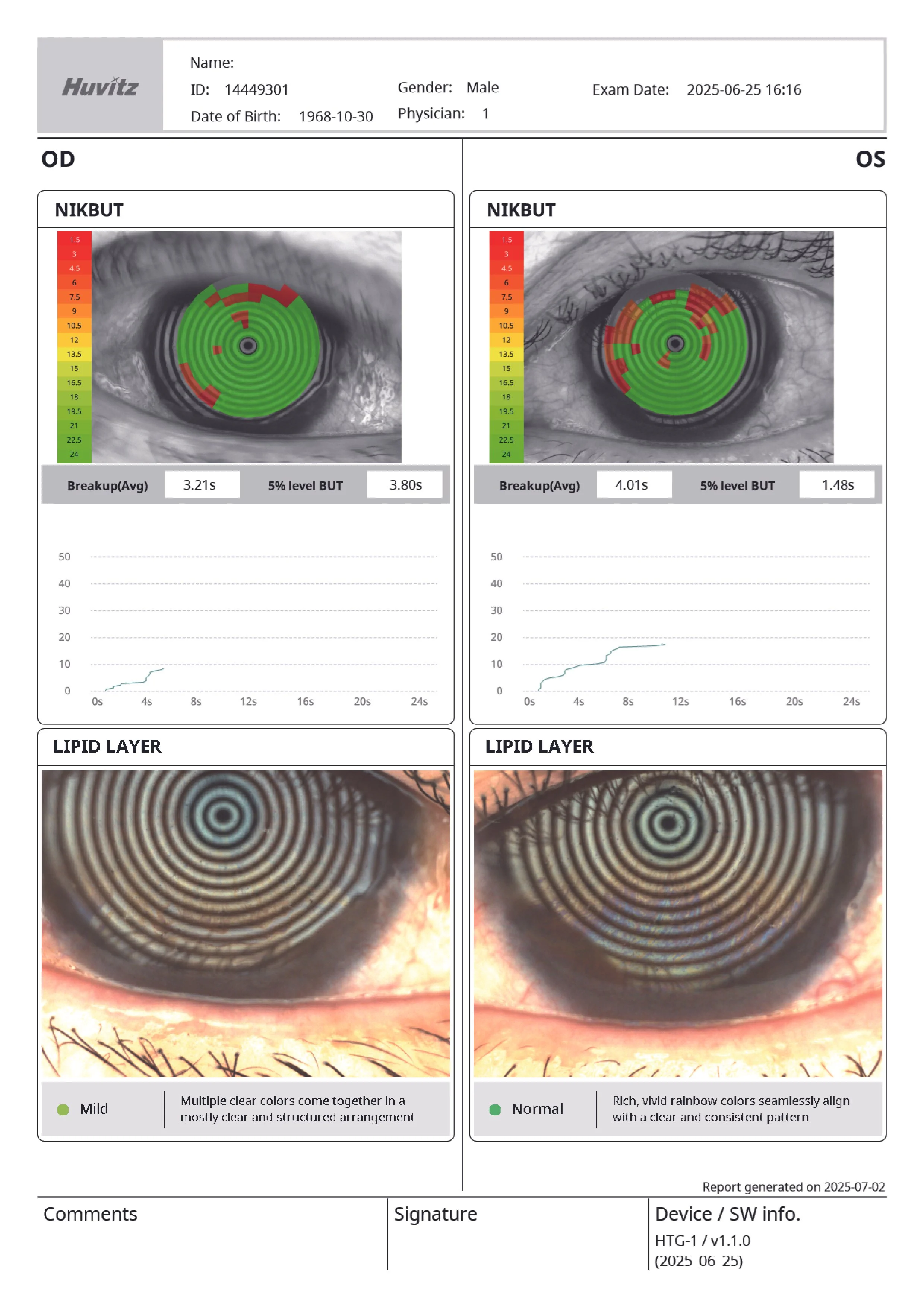 Huvitz HTG-1 Corneal Topographer