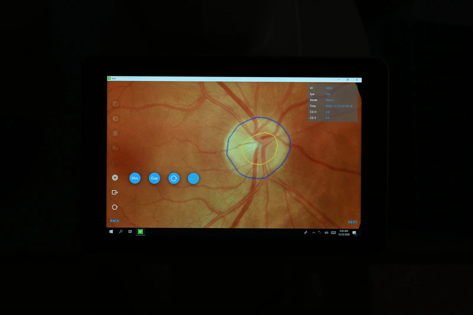 Crystalvue NFC-700 Retinal Camera — Mandarin Opto-Medic